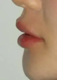 губы 1.webp